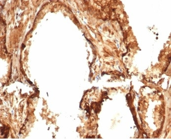 Heat Shock 27kDa Protein 1 Antibody in Immunohistochemistry (Paraffin) (IHC (P))