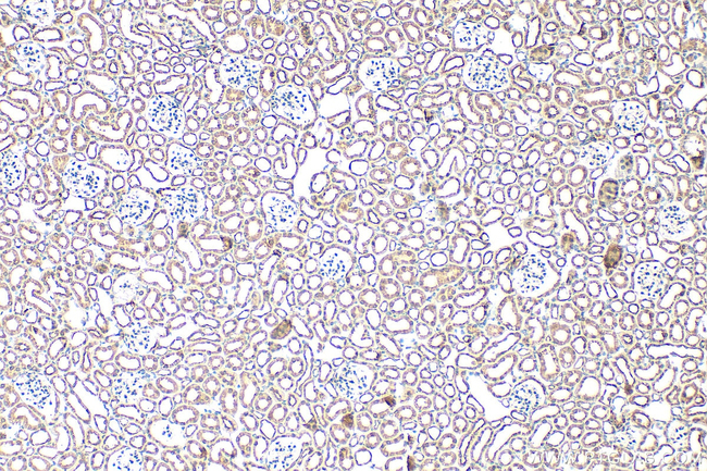NOTCH4 Antibody in Immunohistochemistry (Paraffin) (IHC (P))