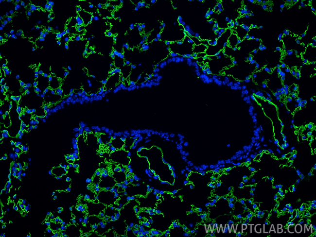 ACE Antibody in Immunohistochemistry (Paraffin) (IHC (P))