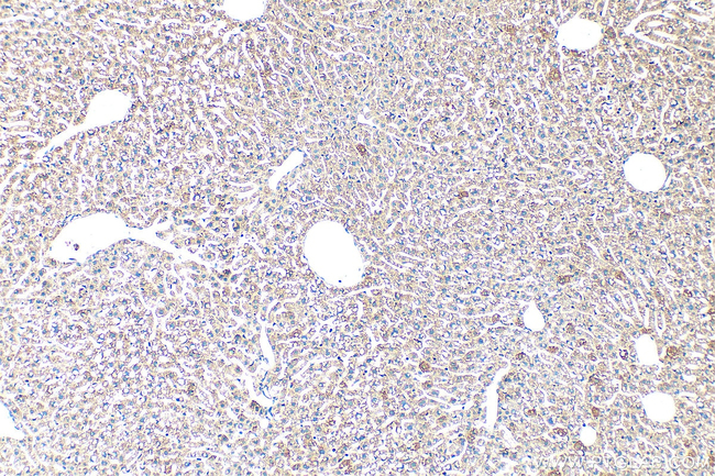 LCAT Antibody in Immunohistochemistry (Paraffin) (IHC (P))