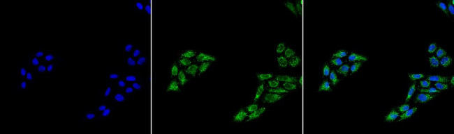 p53 Antibody in Immunocytochemistry (ICC/IF)