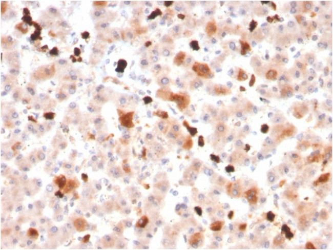 Apolipoprotein A1/APOA1 Antibody in Immunohistochemistry (Paraffin) (IHC (P))