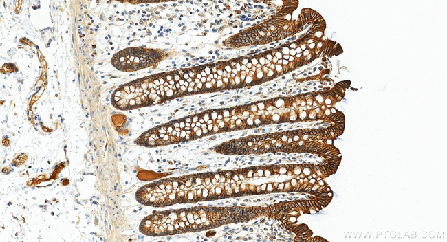 PTPRF Antibody in Immunohistochemistry (Paraffin) (IHC (P))