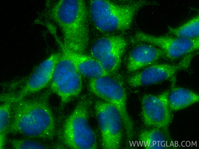 DZIP3 Antibody in Immunocytochemistry (ICC/IF)