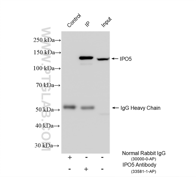 IPO5 Antibody in Immunoprecipitation (IP)