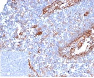 CD54/ICAM-1 Antibody in Immunohistochemistry (Paraffin) (IHC (P))