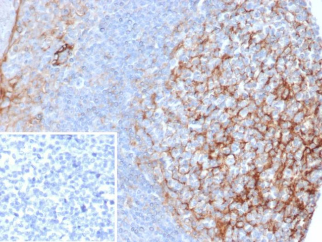 CD54/ICAM-1 Antibody in Immunohistochemistry (Paraffin) (IHC (P))