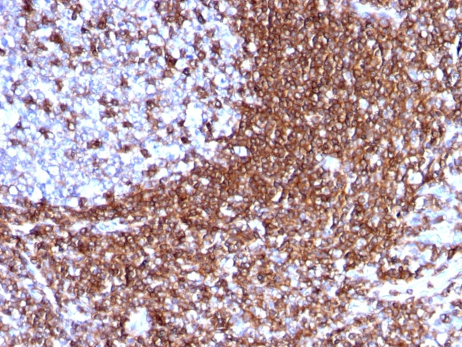 CD50/ICAM3 Antibody in Immunohistochemistry (Paraffin) (IHC (P))