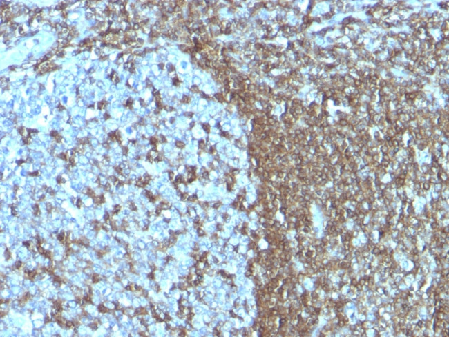 CD50/ICAM3 Antibody in Immunohistochemistry (Paraffin) (IHC (P))
