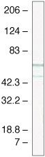 TCF4 Antibody in Western Blot (WB)