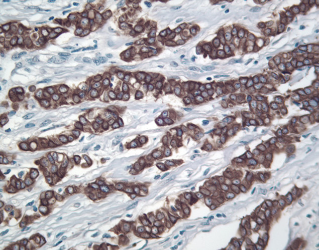 Prolactin Receptor Antibody in Immunohistochemistry (IHC)