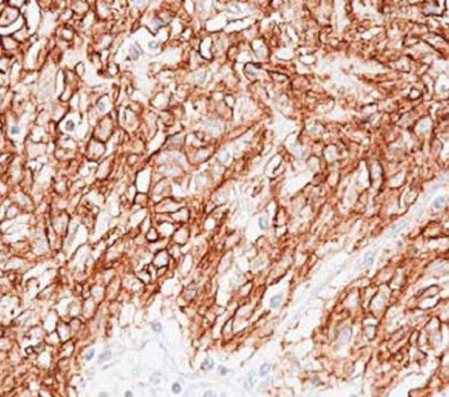 DOG1 Antibody in Immunohistochemistry (Paraffin) (IHC (P))