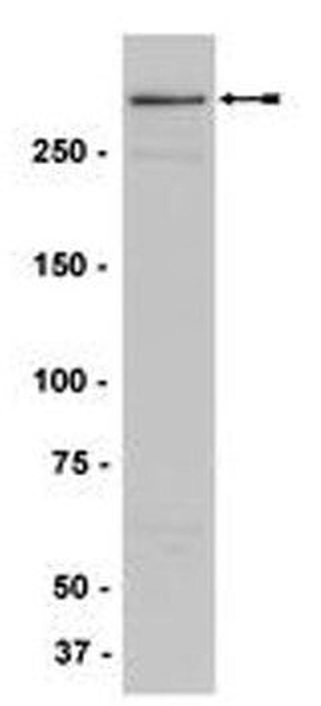 MLL Antibody in Western Blot (WB)