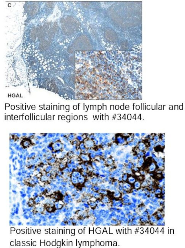 HGAL Antibody in Immunohistochemistry (Paraffin) (IHC (P))