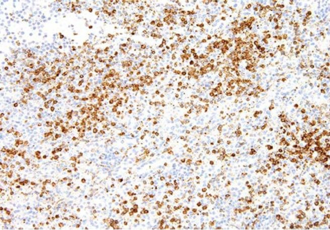 Annexin A1 Antibody in Immunohistochemistry (Paraffin) (IHC (P))