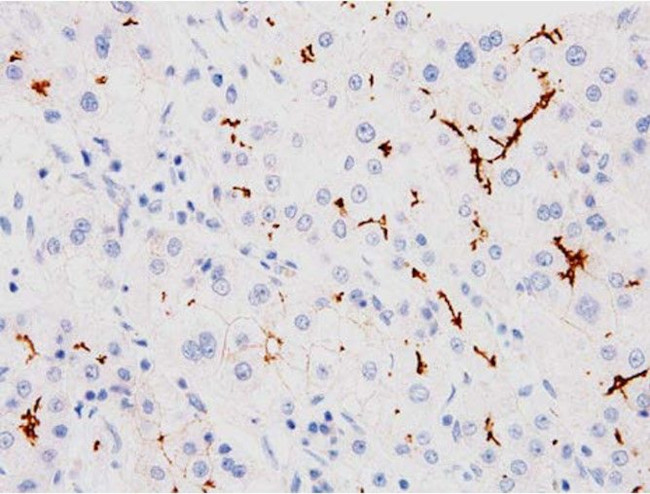 BSEP Antibody in Immunohistochemistry (Paraffin) (IHC (P))
