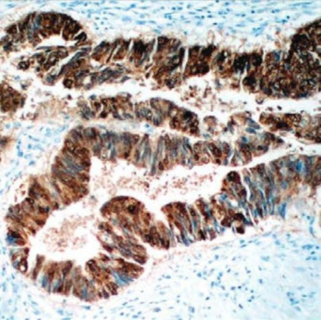 CDX-2 Antibody in Immunohistochemistry (Paraffin) (IHC (P))