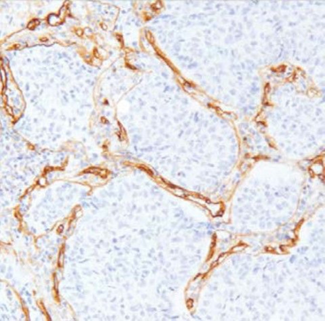 Collagen Type IV Antibody in Immunohistochemistry (Paraffin) (IHC (P))