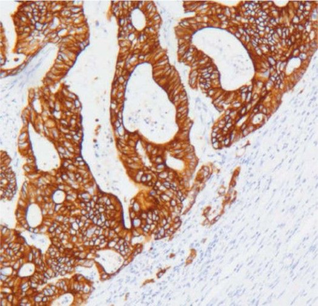 Cytokeratin 19 Antibody in Immunohistochemistry (Paraffin) (IHC (P))