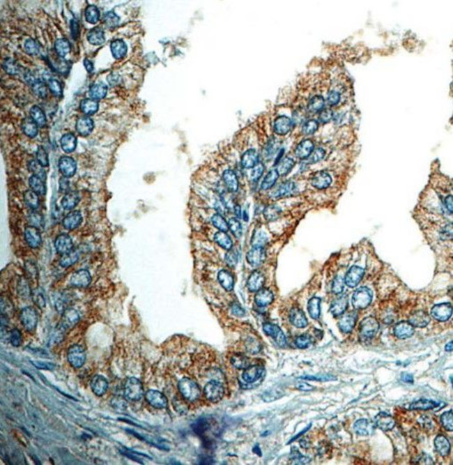 Nerve Growth Factor Receptor (NGFR) Antibody in Immunohistochemistry (Paraffin) (IHC (P))