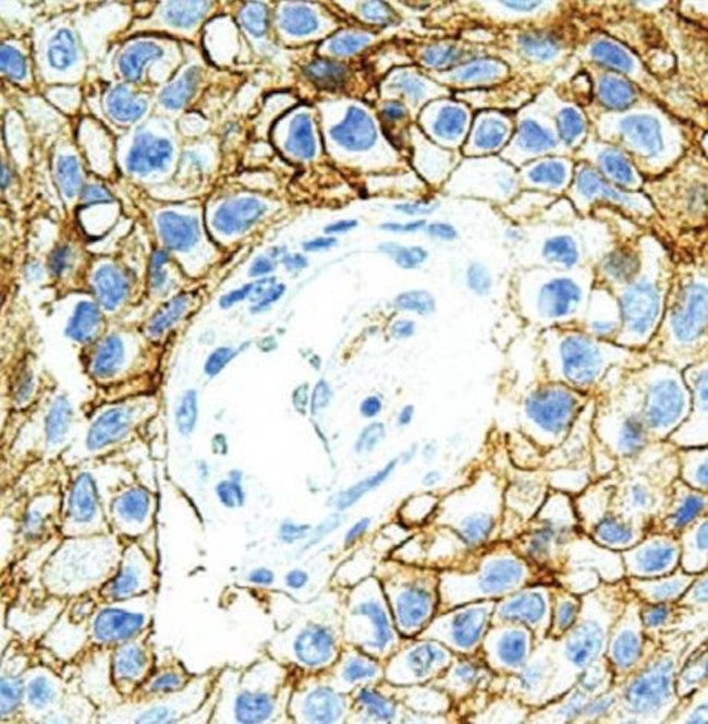 PD-L1 Antibody in Immunohistochemistry (Paraffin) (IHC (P))
