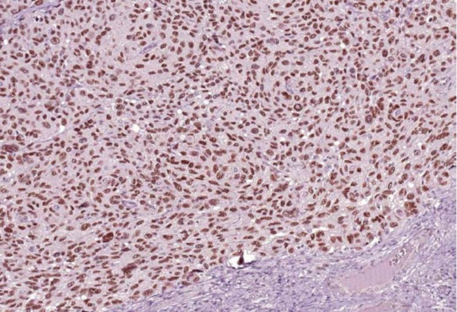 SOX-10 Antibody in Immunohistochemistry (Paraffin) (IHC (P))