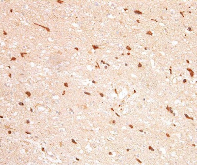 IDH1 Antibody in Immunohistochemistry (Paraffin) (IHC (P))