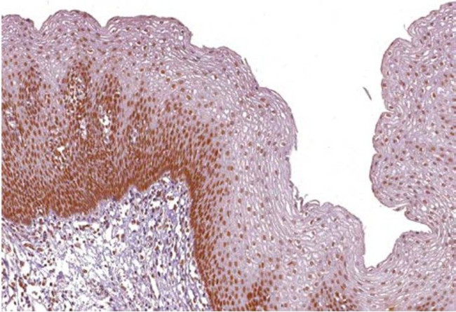 MSH2 Antibody in Immunohistochemistry (Paraffin) (IHC (P))