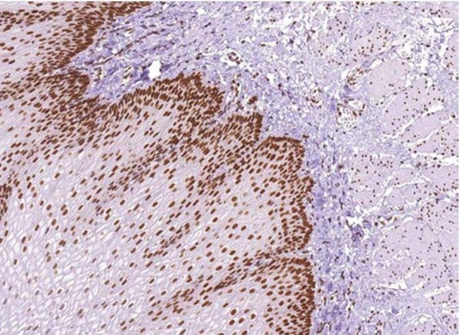 MLH1 Antibody in Immunohistochemistry (Paraffin) (IHC (P))