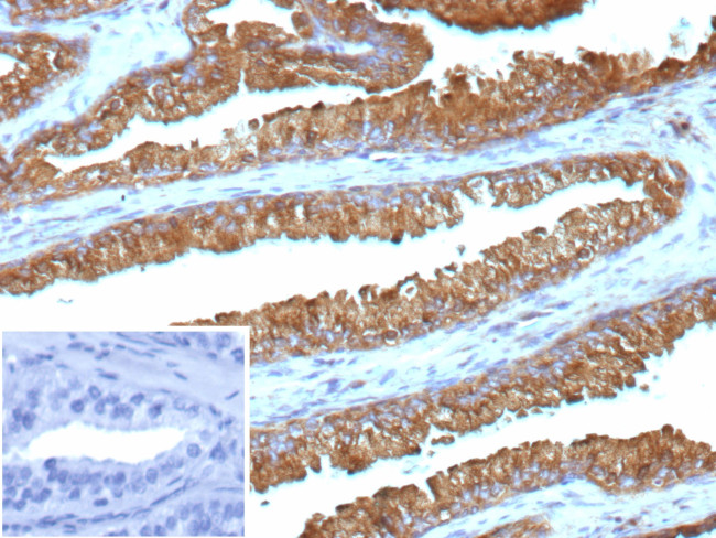 IDH1-R132G (Isocitrate Dehydrogenase) Antibody in Immunohistochemistry (Paraffin) (IHC (P))