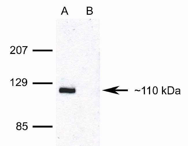 Phospho-Rb (Ser608) Antibody in Western Blot (WB)