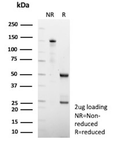 HSD17B13/Hydroxysteroid 17-beta dehydrogenase 13 Antibody in SDS-PAGE (SDS-PAGE)