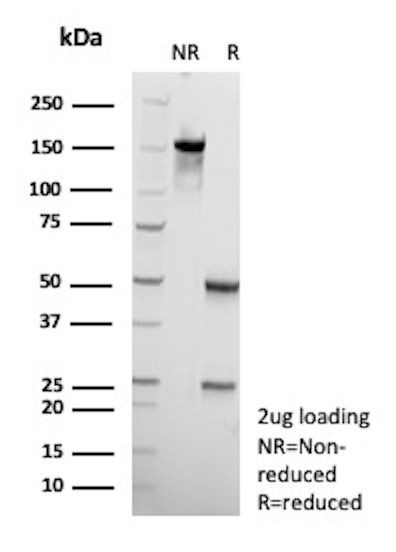 HSD17B13/Hydroxysteroid 17-beta dehydrogenase 13 Antibody in SDS-PAGE (SDS-PAGE)
