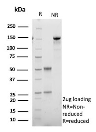 HSD17B13/Hydroxysteroid 17-beta dehydrogenase 13 Antibody in SDS-PAGE (SDS-PAGE)