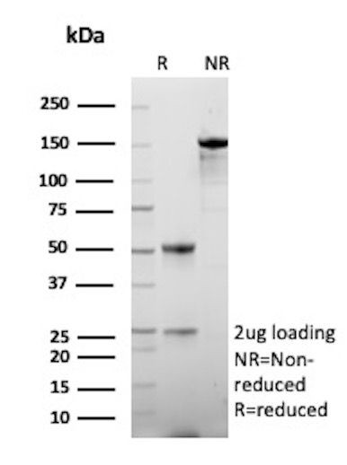 HSD17B13/Hydroxysteroid 17-beta dehydrogenase 13 Antibody in SDS-PAGE (SDS-PAGE)