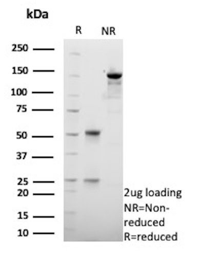 HSD17B13/Hydroxysteroid 17-beta dehydrogenase 13 Antibody in SDS-PAGE (SDS-PAGE)