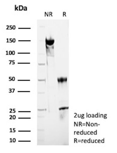 HSD17B13/Hydroxysteroid 17-beta dehydrogenase 13 Antibody in SDS-PAGE (SDS-PAGE)