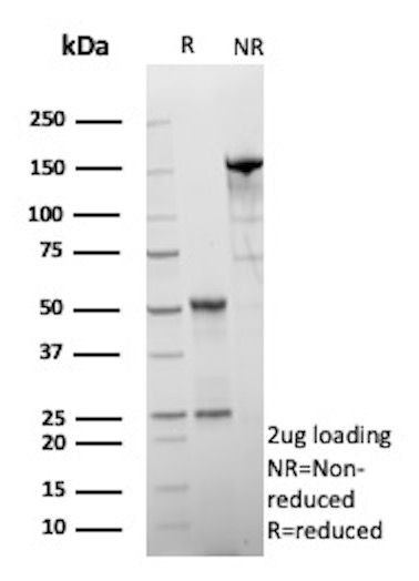 HSD17B13/Hydroxysteroid 17-beta dehydrogenase 13 Antibody in SDS-PAGE (SDS-PAGE)