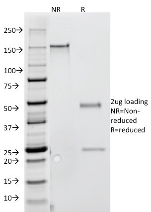 Interferon gamma (IFNG) Antibody in SDS-PAGE (SDS-PAGE)