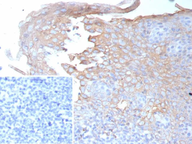 Interferon gamma (IFNG) Antibody in Immunohistochemistry (Paraffin) (IHC (P))