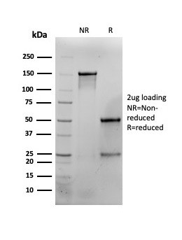 Interferon gamma (IFNG) Antibody in SDS-PAGE (SDS-PAGE)
