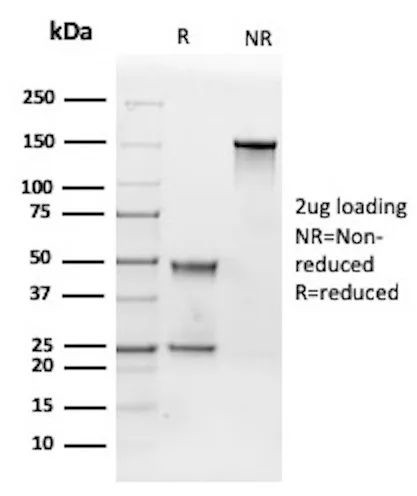 IGF1R alpha/CD221 Antibody in SDS-PAGE (SDS-PAGE)