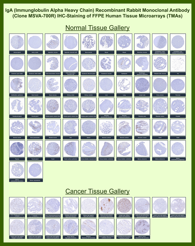 IgA (Immunoglobulin Alpha Heavy Chain) (B-Cell Marker) Antibody in Immunohistochemistry (Paraffin) (IHC (P))