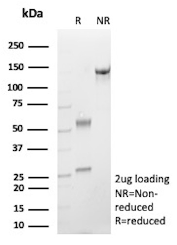 IgE Immunoglobulin Antibody in SDS-PAGE (SDS-PAGE)