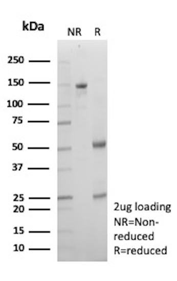 IgG (Immunoglobulin Gamma Heavy Chain) (B-Cell Marker) Antibody in SDS-PAGE (SDS-PAGE)