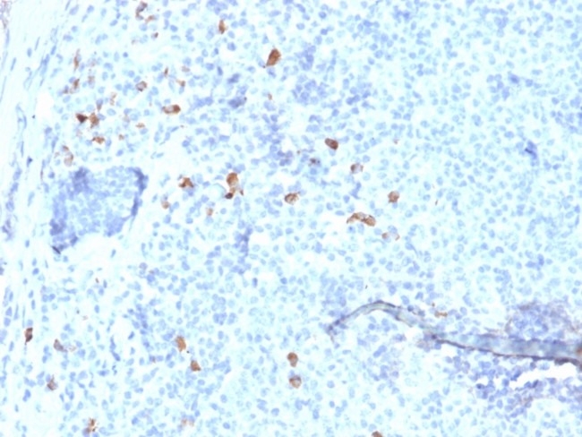 IgG4 (Ig Heavy Constant Gamma 4) (G4m Marker) Antibody in Immunohistochemistry (Paraffin) (IHC (P))