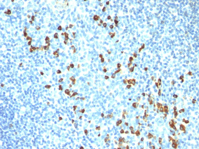 IgM (Immunoglobulin Mu Heavy Chain) (B-Cell Marker) Antibody in Immunohistochemistry (Paraffin) (IHC (P))