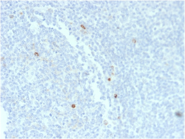 IgM (Immunoglobulin Mu Heavy Chain) Antibody in Immunohistochemistry (Paraffin) (IHC (P))