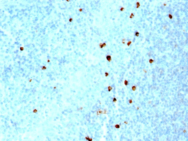 IgM (Immunoglobulin Mu Heavy Chain) (B-Cell Marker) Antibody in Immunohistochemistry (Paraffin) (IHC (P))