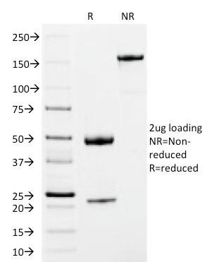 IgM (Immunoglobulin Mu Heavy Chain) (B-Cell Marker) Antibody in SDS-PAGE (SDS-PAGE)